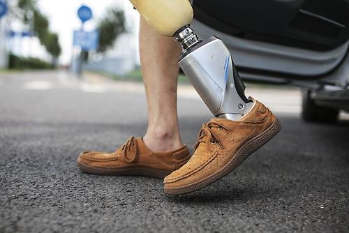 一具普通的假肢價格在多少范圍內較合適?(圖2) 假肢價格